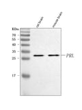 Anti-Prolactin/PRL Antibody Picoband®