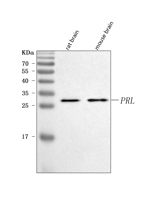 Anti-Prolactin/PRL Antibody Picoband®