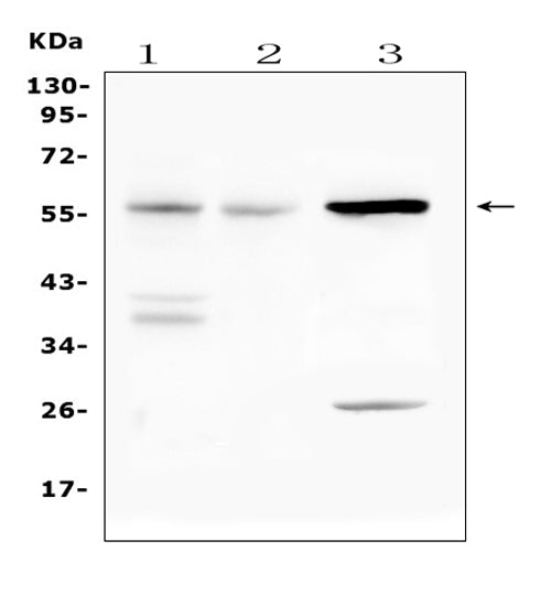 Anti-IL23 Receptor/Il23r Antibody Picoband®