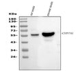 Anti-Cytochrome P450 17A1/Cyp17a1 Antibody Picoband®