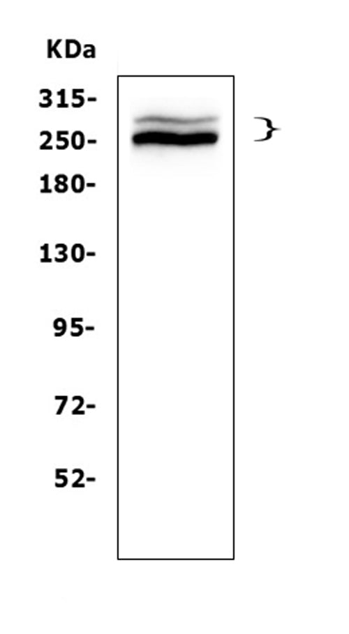 Anti-Desmoplakin/DSP Antibody Picoband®