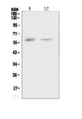 Anti-CSF1 Antibody Picoband®