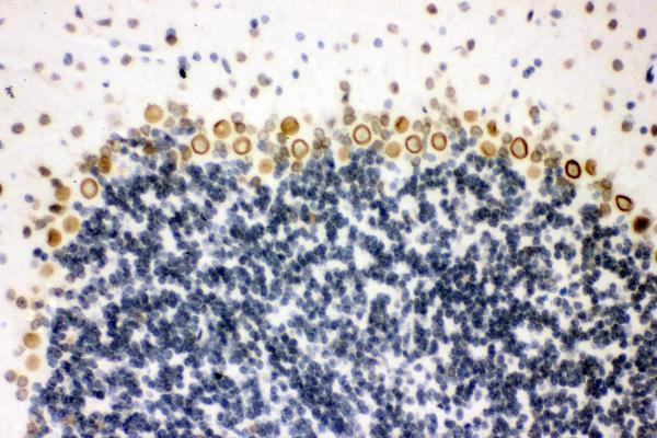 Anti-Sumo 1/SUMO1 Antibody