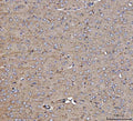 Anti-Dkk1 Antibody