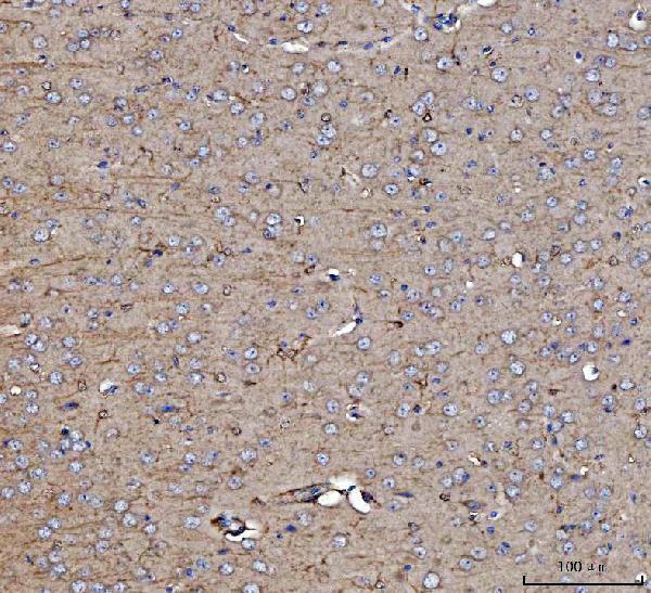 Anti-Dkk1 Antibody