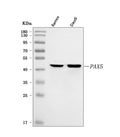 Anti-BSAP/PAX5 Antibody Picoband®