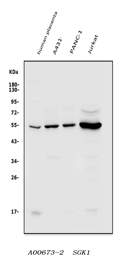 Anti-SGK1 Antibody Picoband®