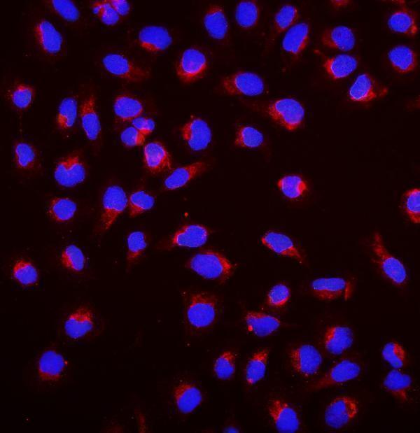 Anti-SGK1 Antibody Picoband®