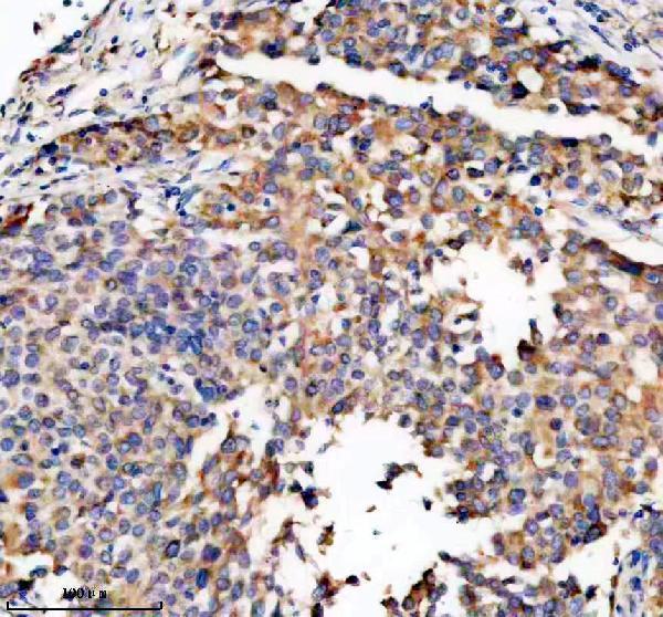 Anti-TRIO Antibody