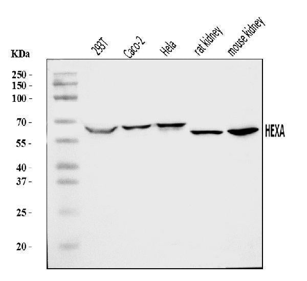 Anti-HEXA Antibody Picoband®