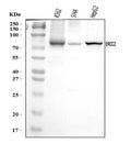 Anti-XPD/ERCC2 Antibody Picoband®