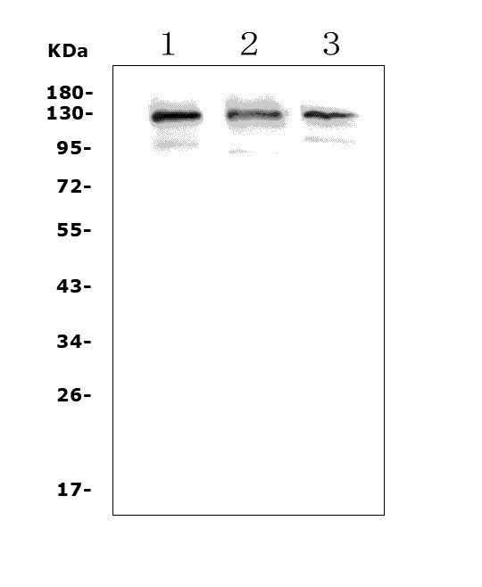 Anti-Growth hormone receptor/GHR Picoband® Antibody