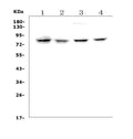 Anti-Growth hormone receptor/GHR Picoband® Antibody