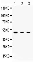 Anti-Protein Kinase A regulatory subunit I alpha/PRKAR1A Antibody Picoband®
