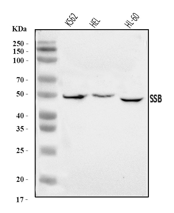 Anti-SSB Antibody Picoband®
