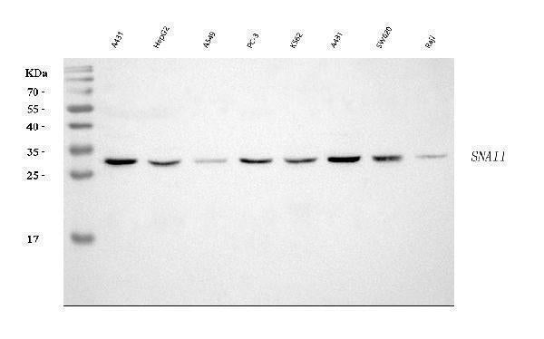 Anti-SNAIL/SNAI1 Antibody Picoband®