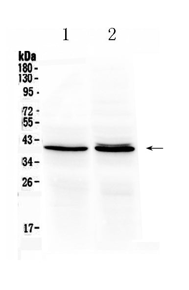 Anti-Ornithine Carbamoyltransferase/OTC Antibody Picoband®