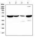 Anti-Argininosuccinate Lyase/ASL Antibody Picoband®