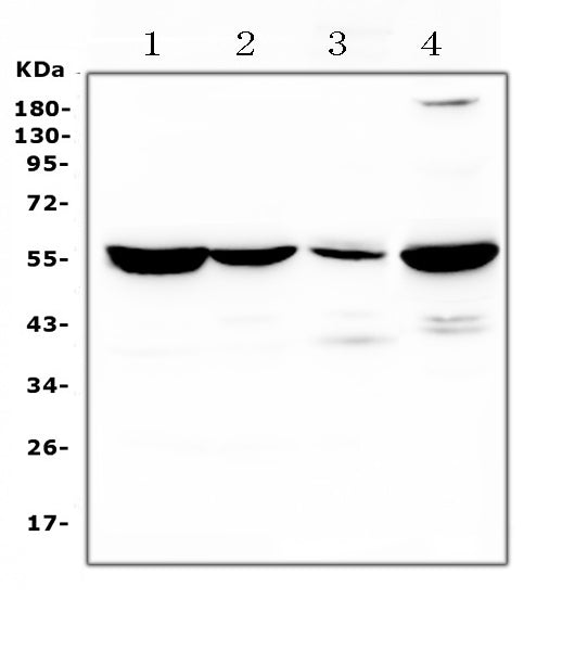 Anti-Argininosuccinate Lyase/ASL Antibody Picoband®