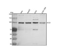 Anti-ACE2 Antibody Picoband®