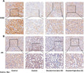 Anti-Estrogen Receptor beta/ESR2 Antibody Picoband®
