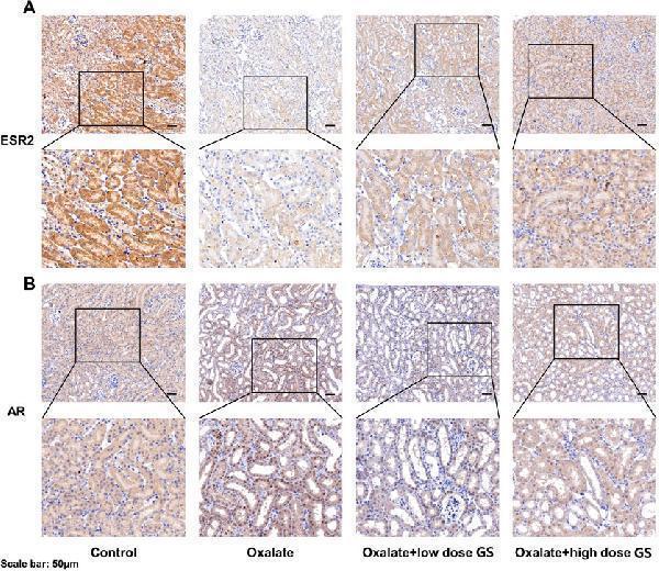 Anti-Estrogen Receptor beta/ESR2 Antibody Picoband®