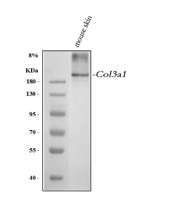 Anti-Collagen III/COL3A1 Antibody Picoband®