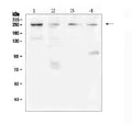 Anti-TRPM7 Antibody Picoband®