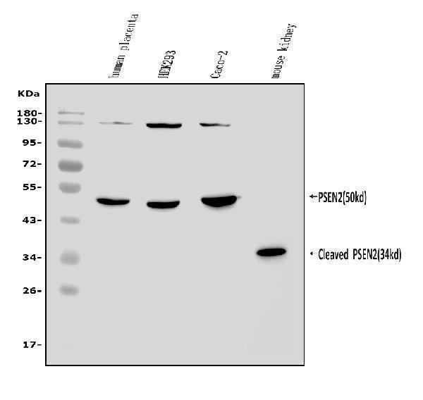 Anti-Presenilin 2/AD5/PSEN2 Antibody Picoband®