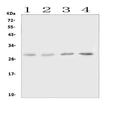 Anti-Oncostatin M/Osm Antibody Picoband®