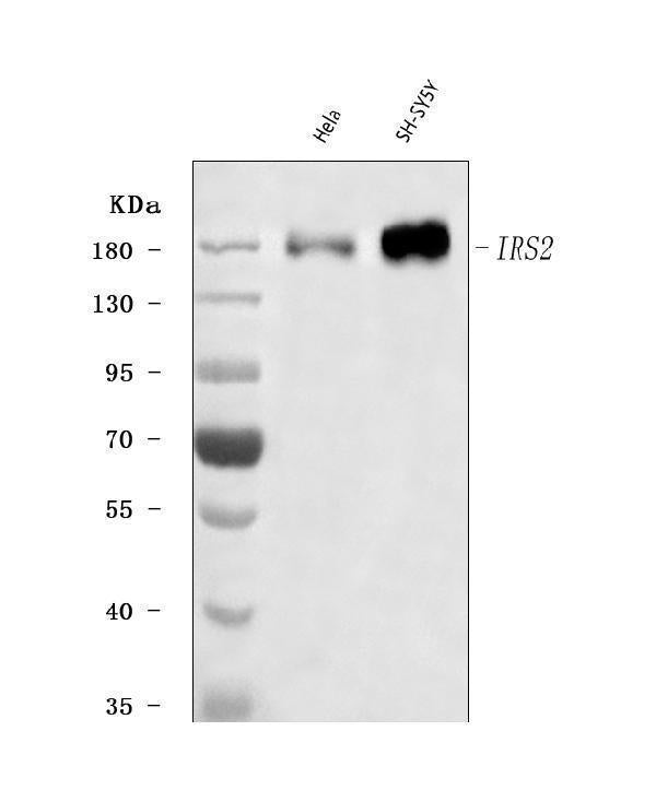 Anti-IRS2 Antibody Picoband®