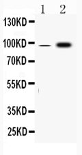 Anti-Fibrinogen alpha chain/FGA Antibody Picoband®