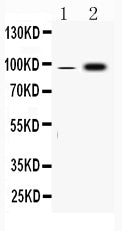Anti-Fibrinogen alpha chain/FGA Antibody Picoband®