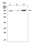 Anti-Fibrinogen alpha chain/FGA Antibody Picoband®