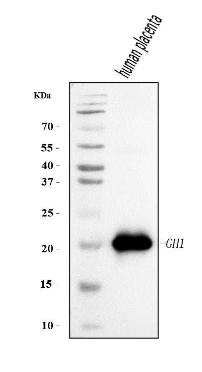 Anti-Growth Hormone/GH1 Antibody Picoband®