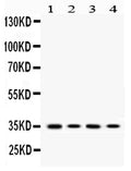 Anti-MC1 Receptor/MC1R Antibody Picoband®
