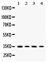 Anti-MC1 Receptor/MC1R Antibody Picoband®