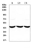 Anti-ADA Antibody Picoband®