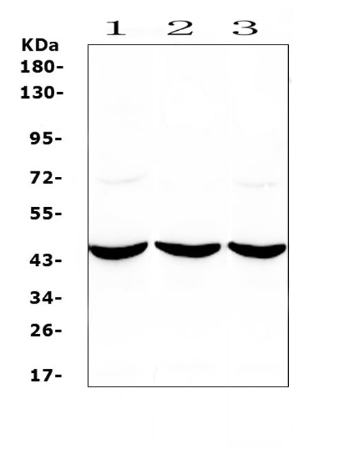 Anti-ADA Antibody Picoband®