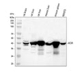 Anti-ADA Antibody Picoband®