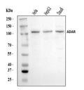 Anti-ADAR1/ADAR Antibody Picoband®