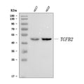 Anti-TGF beta 2/TGFB2 Antibody Picoband®