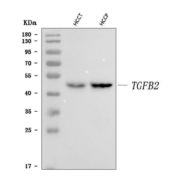 Anti-TGF beta 2/TGFB2 Antibody Picoband®