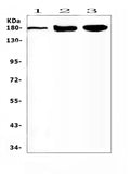 Anti-SUR1/ABCC8 Antibody Picoband®