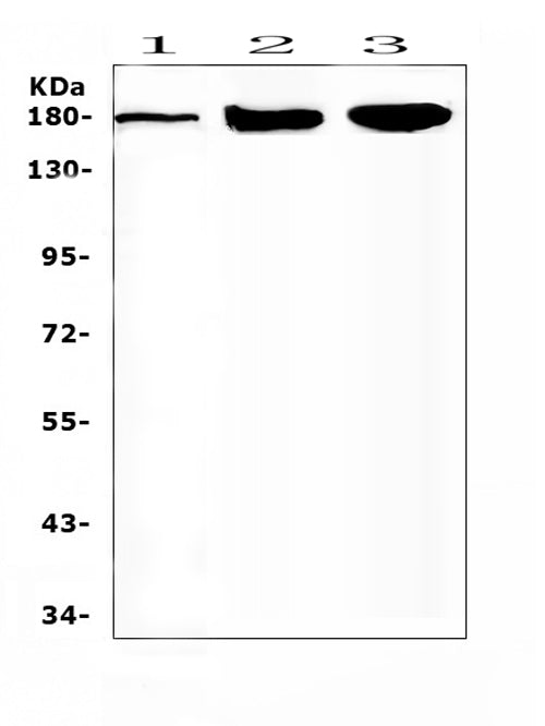 Anti-SUR1/ABCC8 Antibody Picoband®