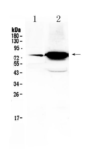 Anti-FSH Receptor/FSHR Antibody Picoband®