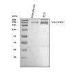 Anti-VEGF Receptor 2/KDR Antibody Picoband®