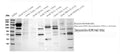 Anti-VEGF Receptor 2/Kdr Antibody Picoband®