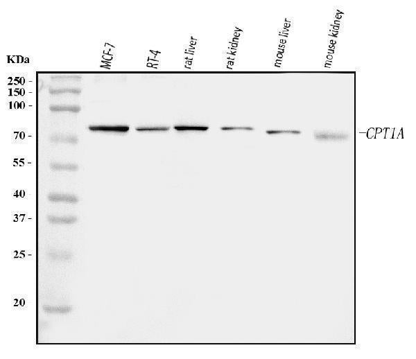 Anti-CPT1A Antibody Picoband®