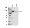 Anti-EML4 Antibody Picoband®